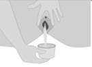 Opvangen Urine Vagina
