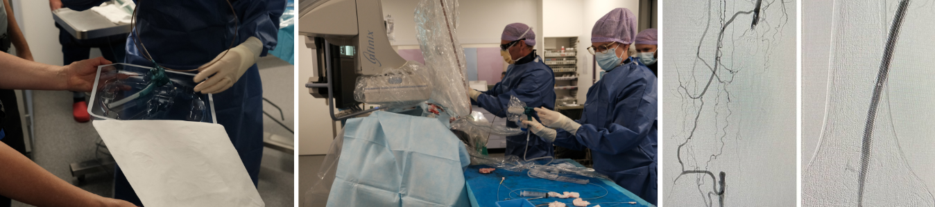 1E Patient Rotarex Afbeelding Banner Website 1348X299 7 (1)